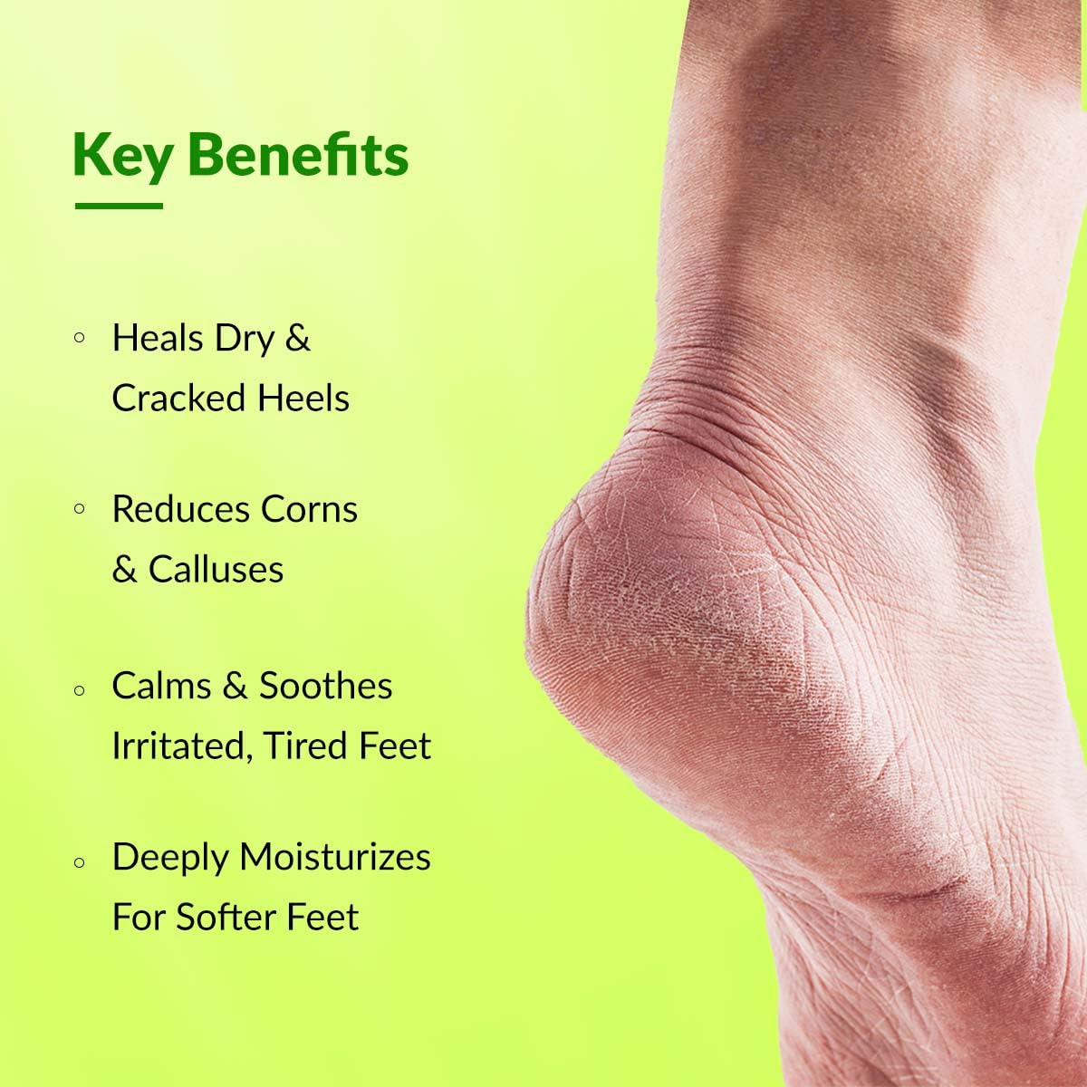 Fixderma Foobetik Foot Cream - 100 gm