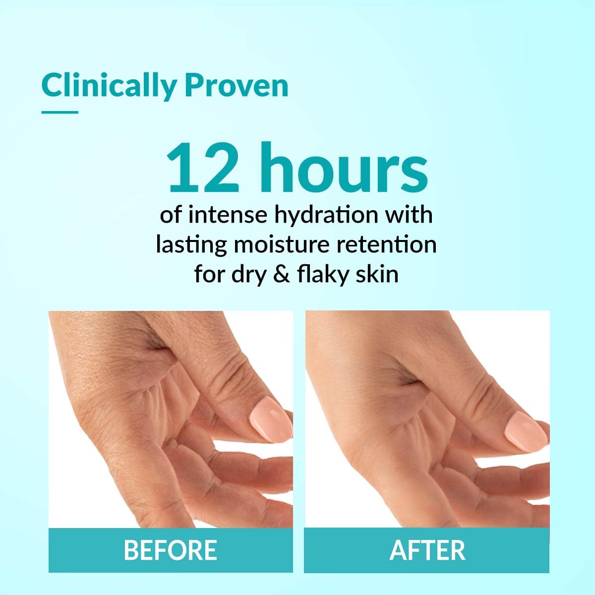 Fixderma Moisturizing Cream For Dry Skin - 60 gm