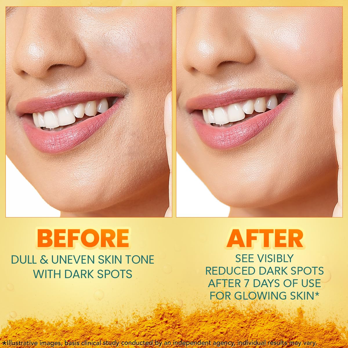 Himalaya Dark Spot Clearing Turmeric Face Serum for glowing skin