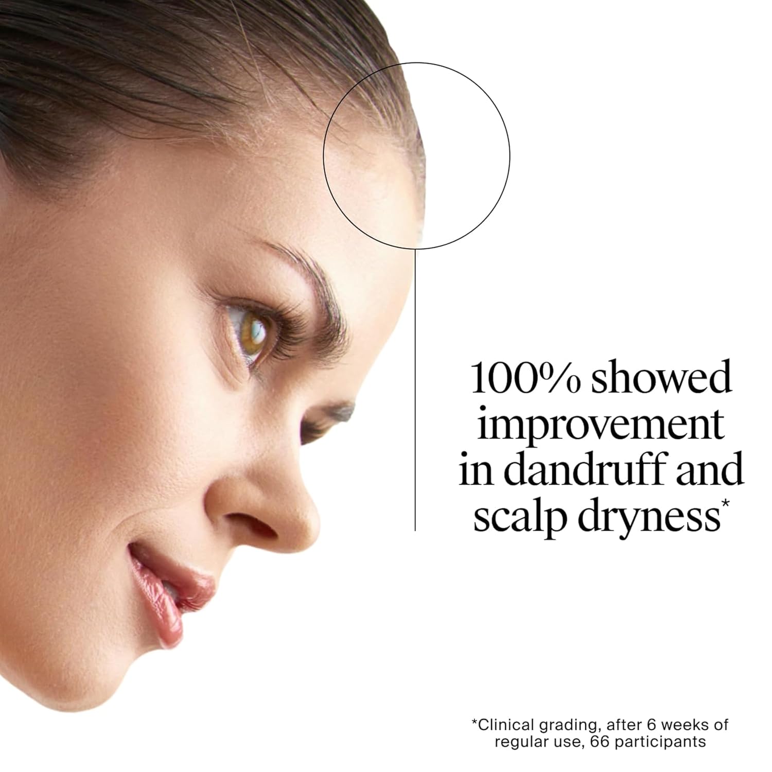 Neutrogena T/Gel Therapeutic Shampoo - 250 ml