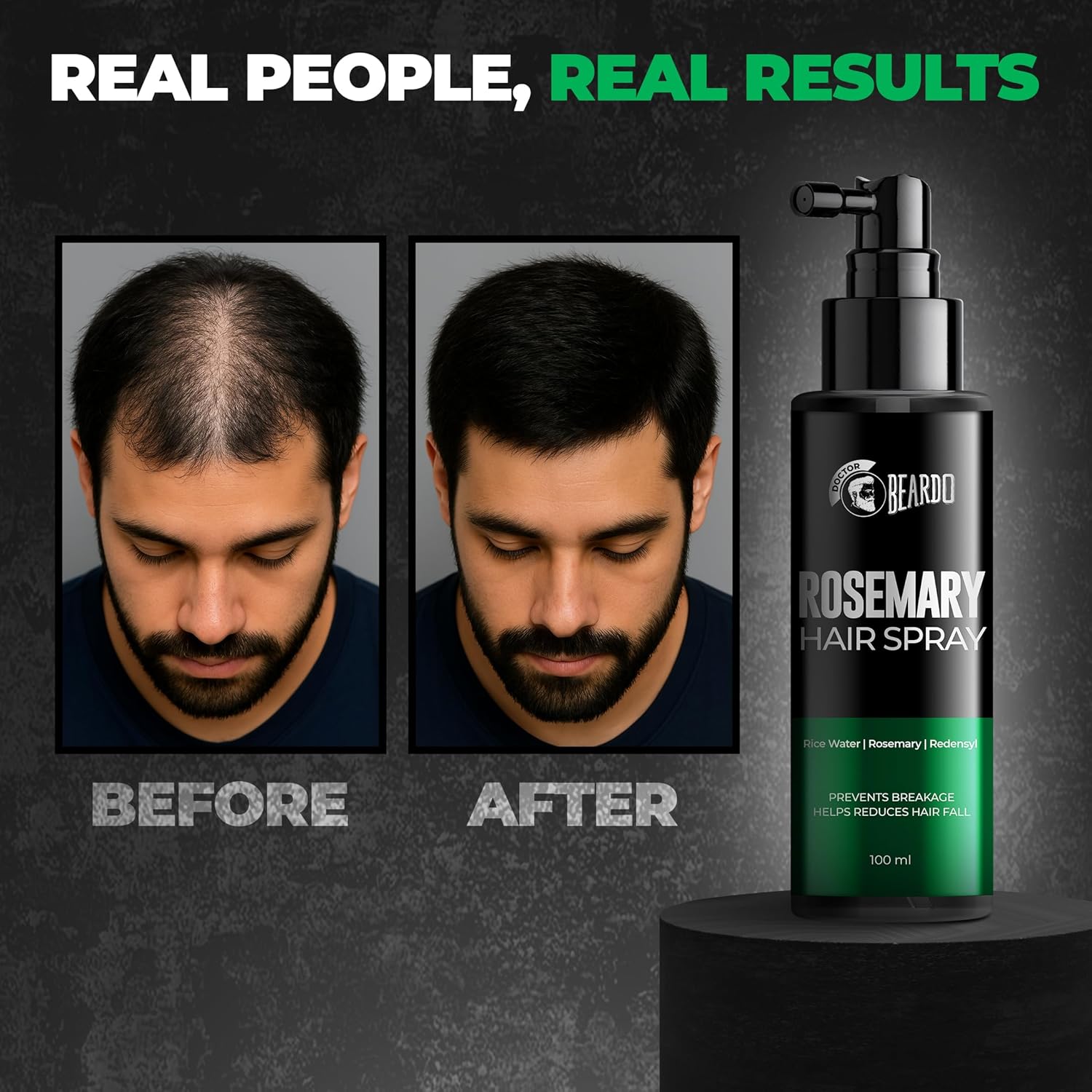 Beardo Rosemary Hair Spray with Redensyl & Rice Water | Activates Natural Hair Growth, Reduces Hair Fall & Breakage | Strengthens Roots | Non-Sticky Daily Hair Tonic for Men- 100ml