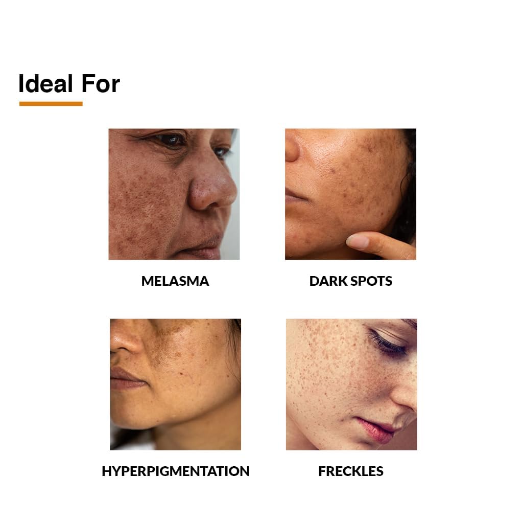 Fixderma Skarfix-Plus Cream - 15 gm