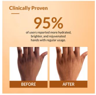 Fixderma Hand Cream for Dry and Rough Hands - 30 gm
