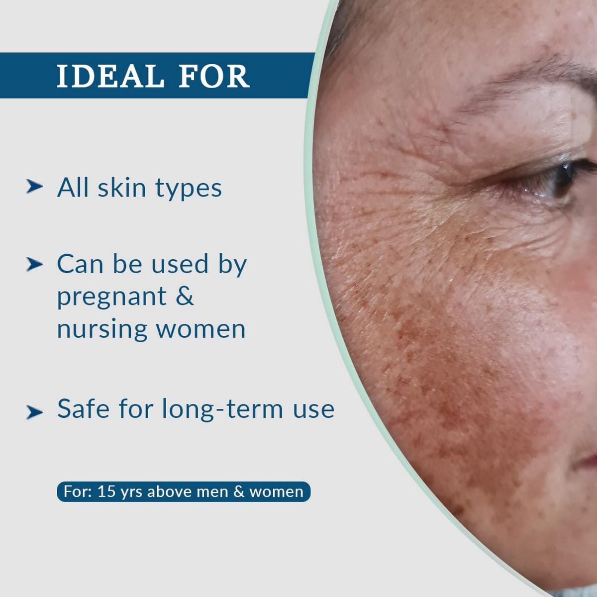 Fixderma AHA Lightening Gel - 30 ml