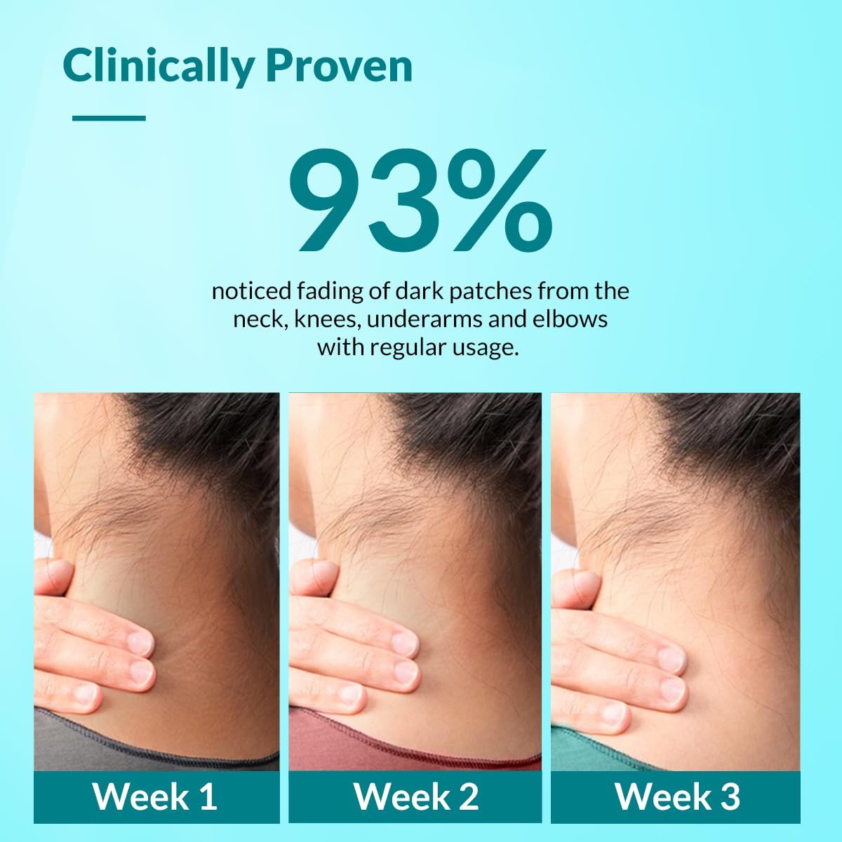 Fixderma Nigrifix Cream - 50 gm