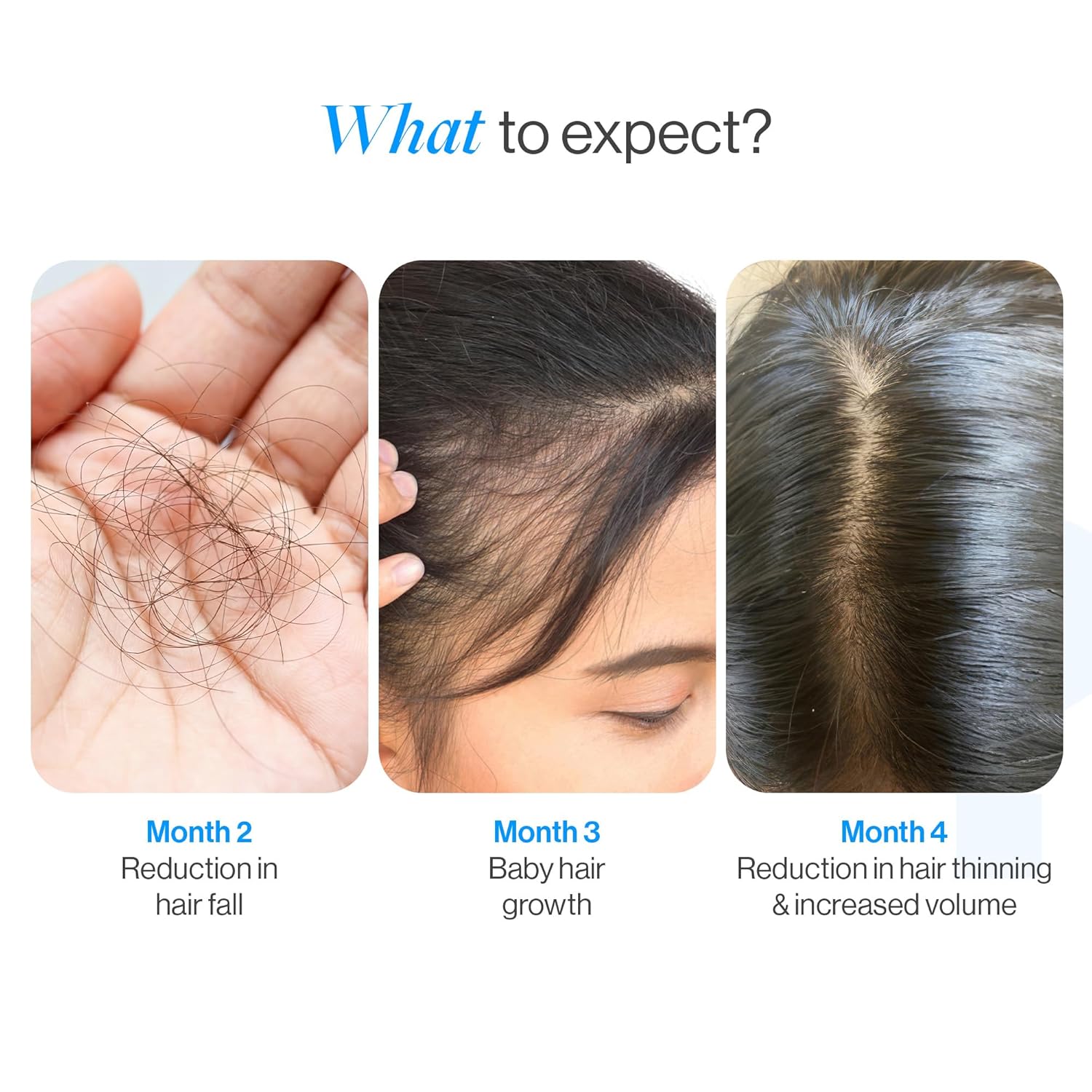 BeBodywise Rosemary Hair Growth Serum (Roll On) - 25 ml