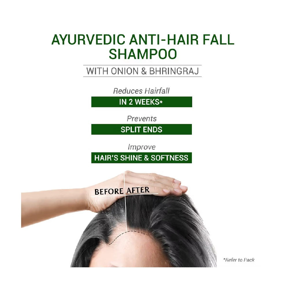 sesa Ayurvedic Anti-Hair Fall Shampoo with Bhringraj and Onion for Soft & Shiny Hair (200 ml)
