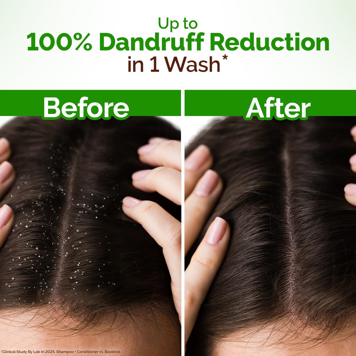 Mamaearth Lemon Anti-Dandruff Shampoo For Itchy & Flaky Scalp - 250 ml