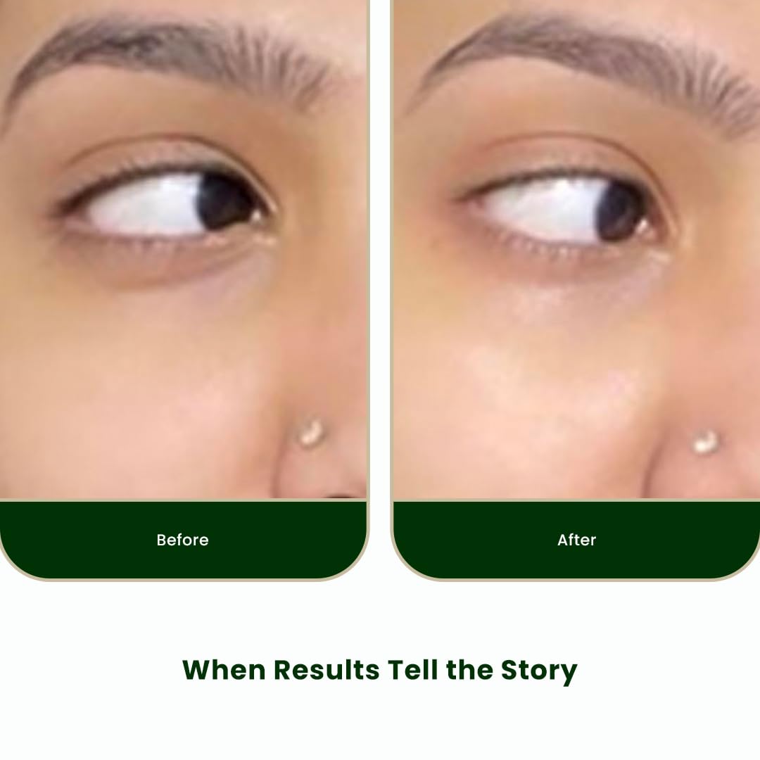 Skog Under Eye Repair Oil - 10 ml