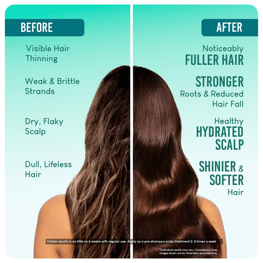 Careberry 100% Organic Rosemary & Jojoba Anti Dandruff Hair Oil - 200 ml