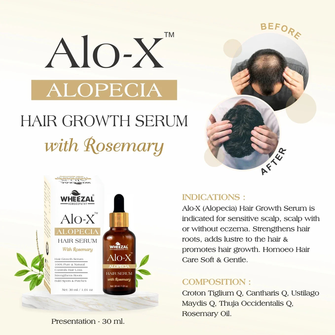 Wheezal Alo-X Alopecia Hair Serum - 30 ml