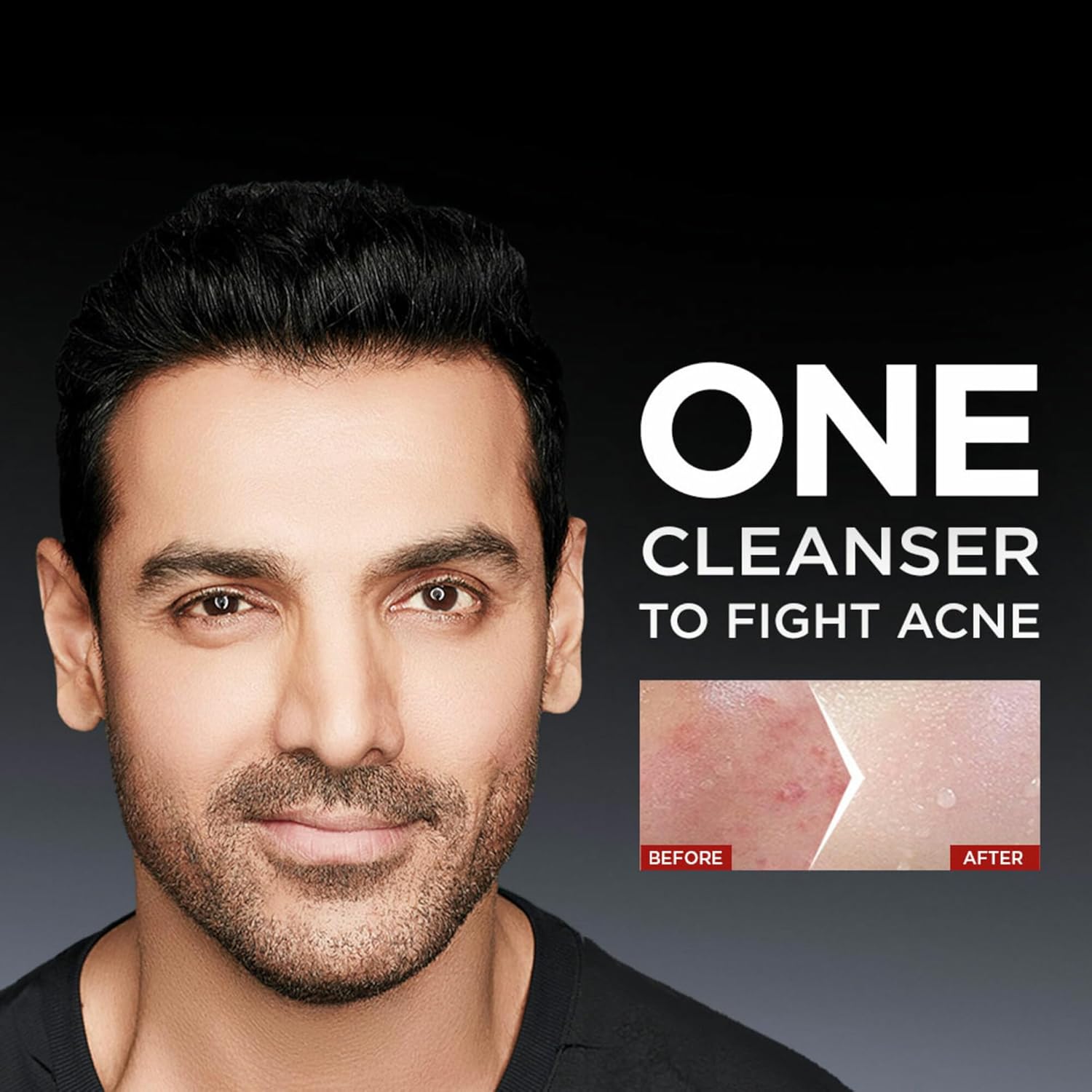 Garnier Men Acno Fight 6-in-1 Anti-Pimple Face wash - 100 ml