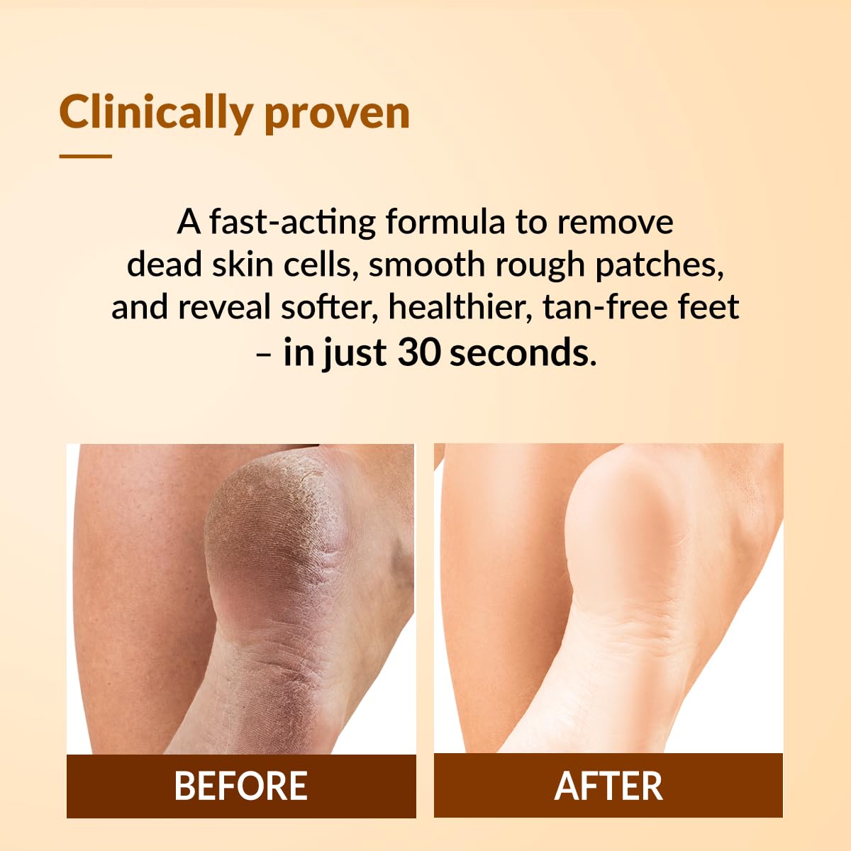 Fixderma Foobetik Foot Scrub Spray - 50 ml