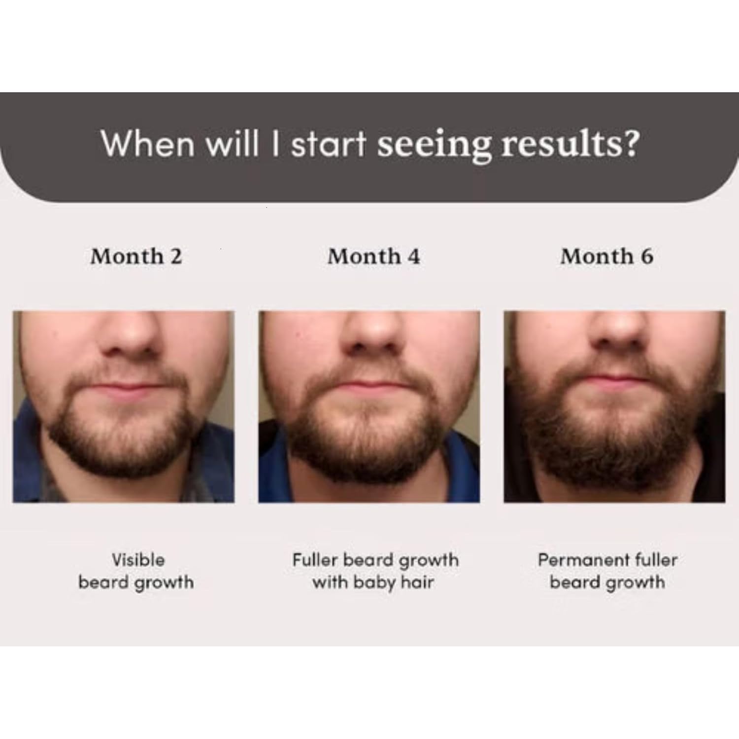 Man Matters Beardmax Growth Serum, Minoxidil 5% - 30 ml