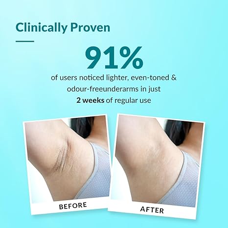 Fixderma Nigrifix Underarm Lightening Roll on with 6% AHA, Lactic Acid & 1% Mandelic Acid, Brightens Skin & Exfoliates Underarm - 60 ml