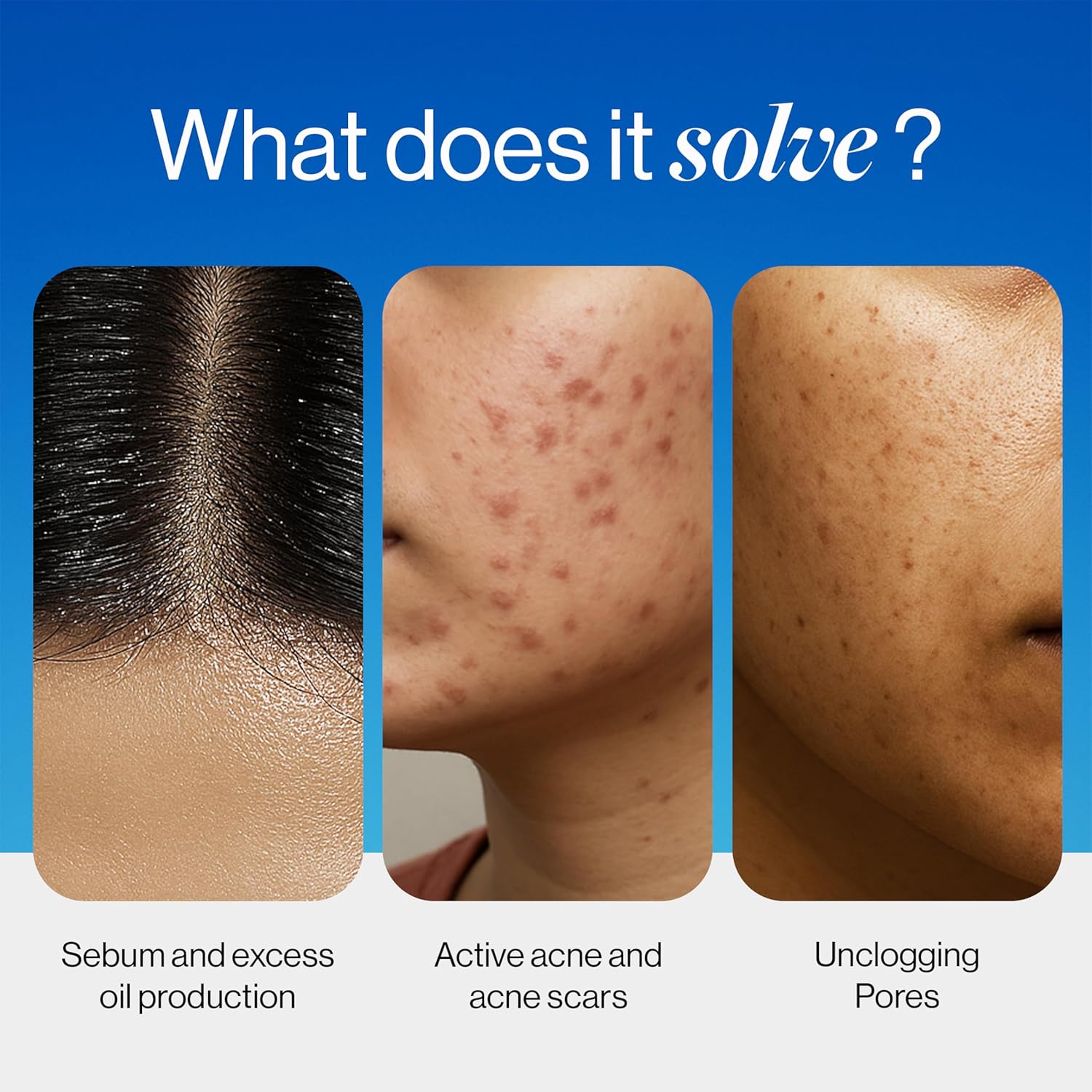 BeBodywise 2% Salicylic Acid Face Wash for Acne-Prone Skin - 100 ml
