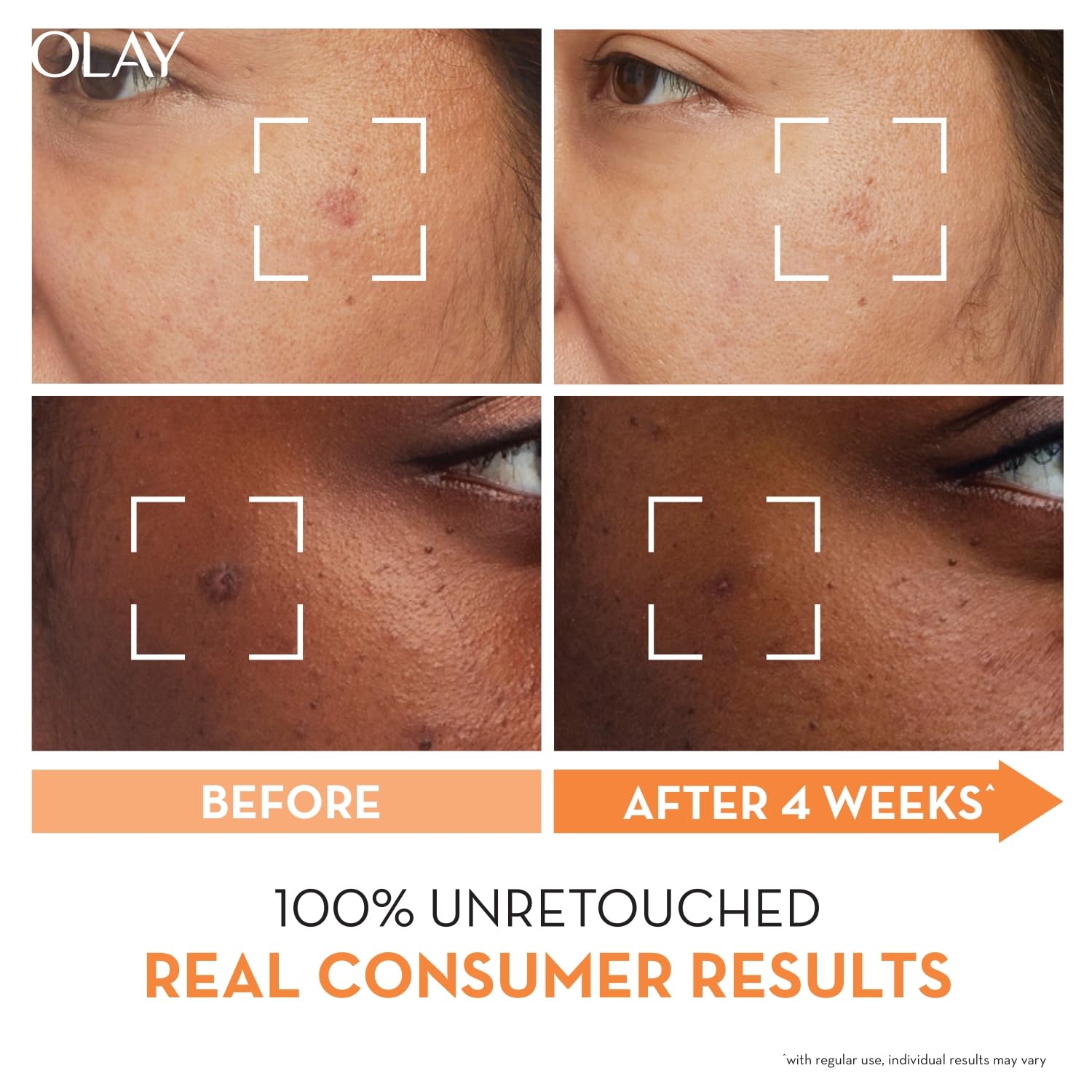 Niacinamide Super Serum 30ml Olay