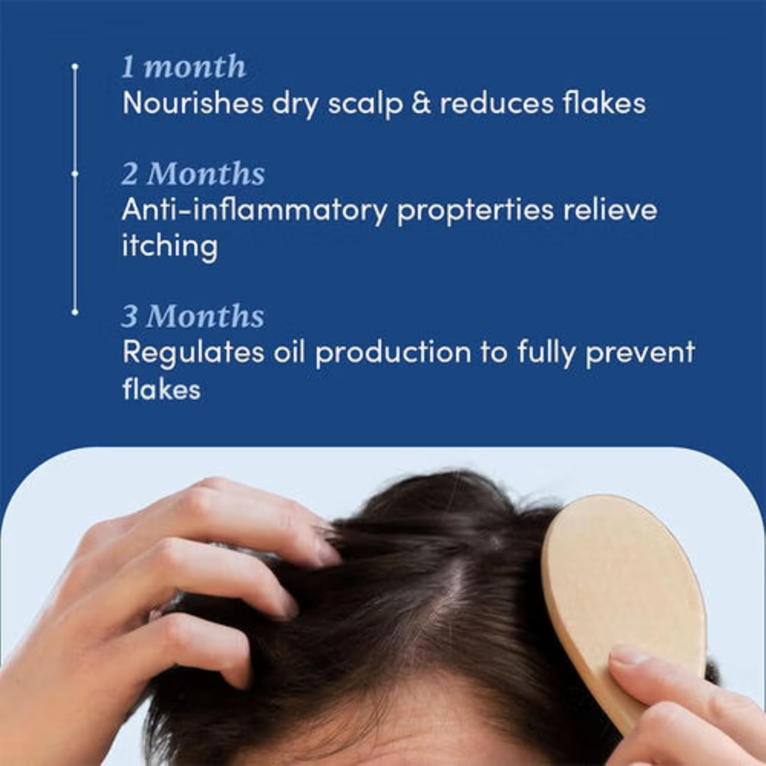 Man Matters 1% Ketoconazole Anti-Dandruff Shampoo, Reduces Itching & Dandruff - 100 ml