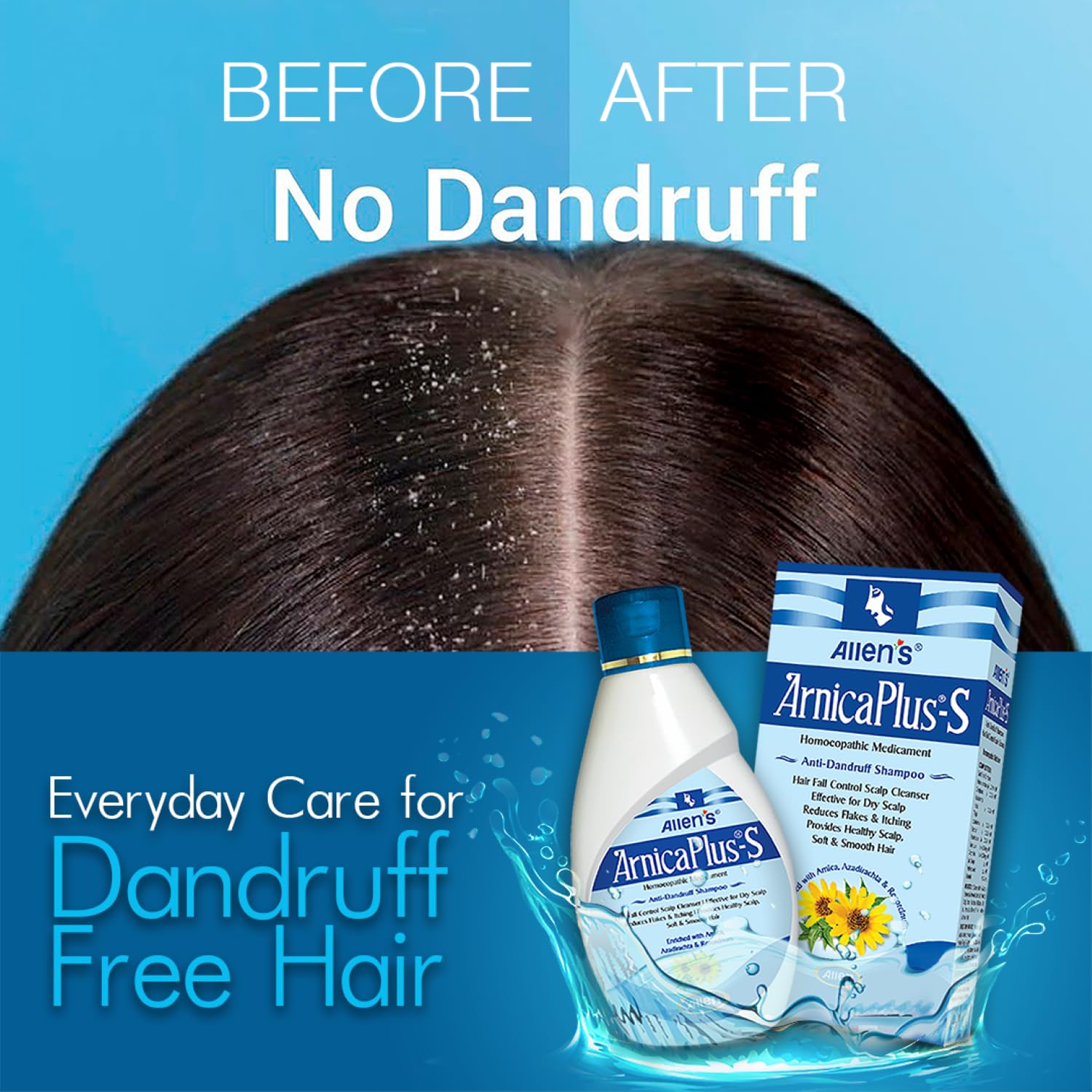 Allen's Homeopathy ArnicaPlus-S Anti Dandruff Hair & Scalp Cleanser - 100 ml