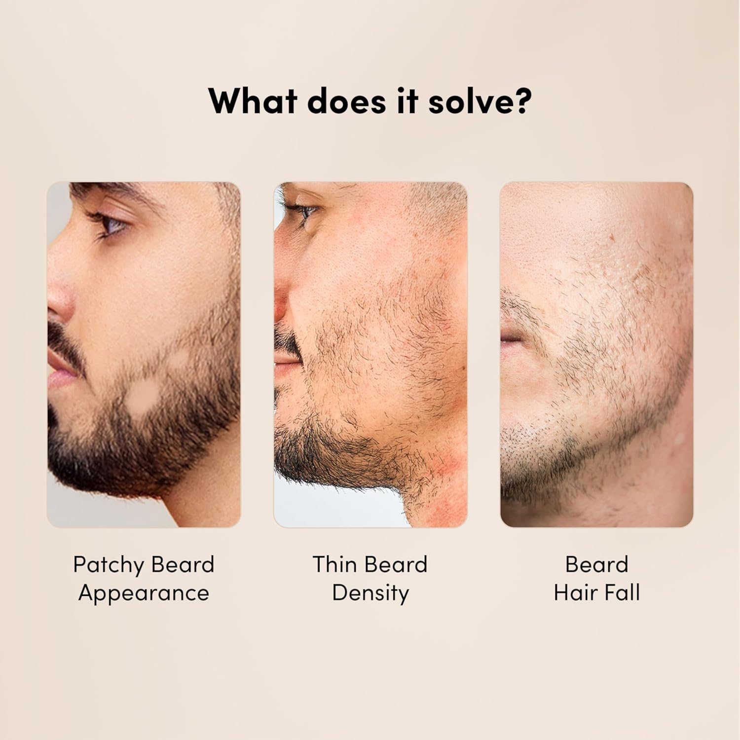 Man Matters Beardgro Oil-In-Serum - 30 ml