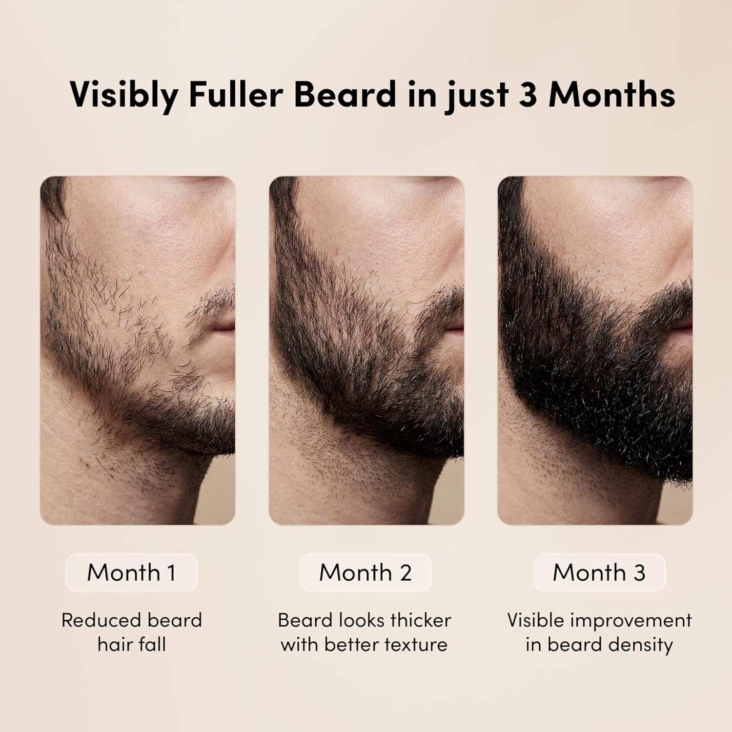 Man Matters Beardgro Oil-In-Serum - 30 ml
