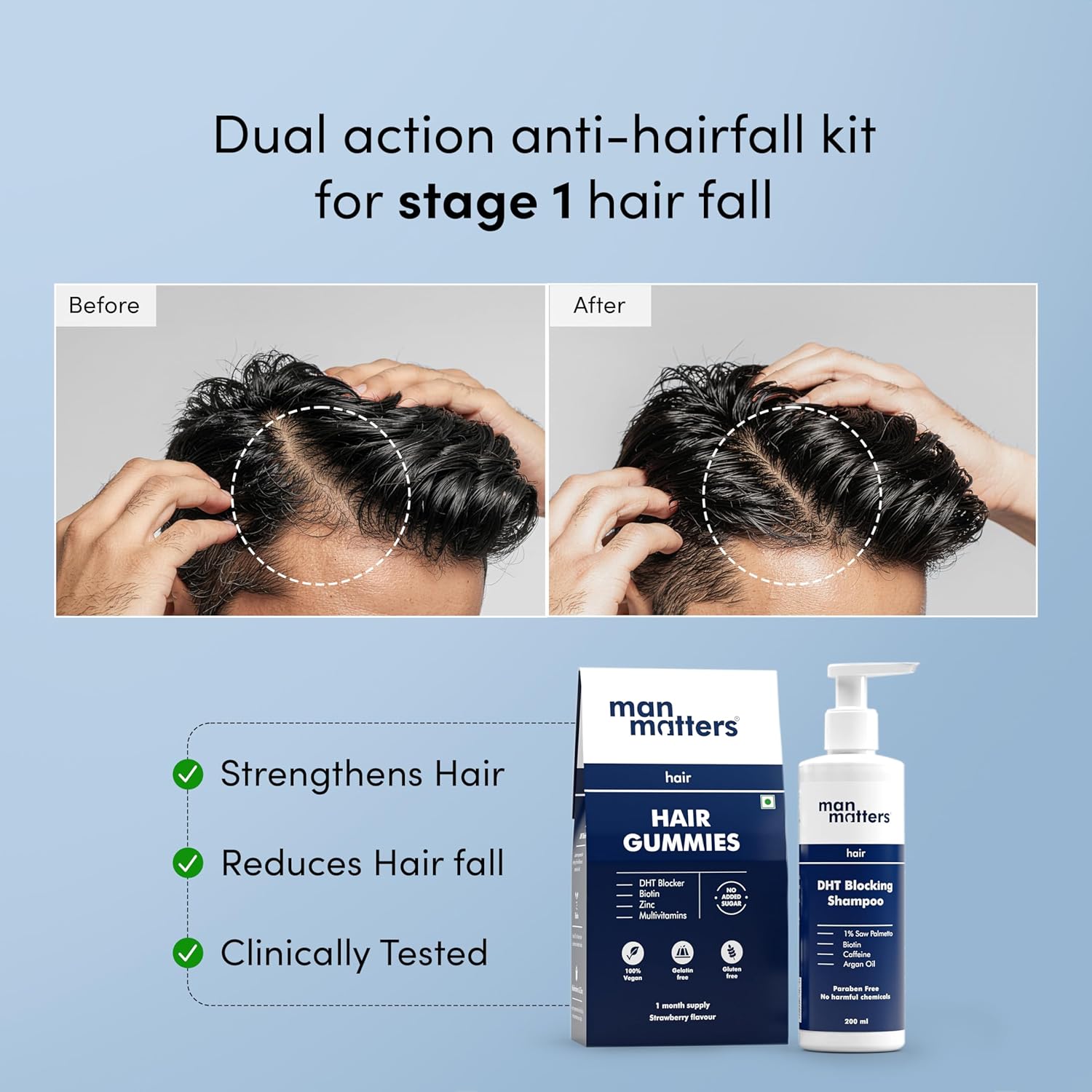 Man Matters Biotin Hair Gummies & Anti Hair Fall Shampoo Combo - combo