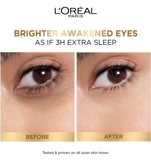 LOreal Paris Glycolic Bright Dark Circle Eye Serum With 3% [Glycolic + Vit Cg + Niacinamide] 20 ml