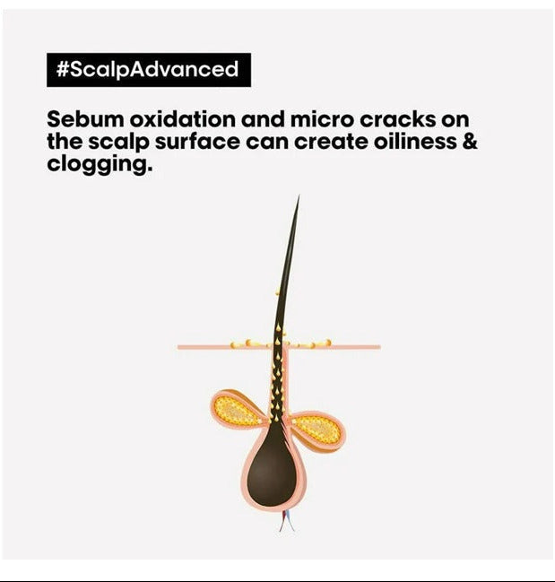 LOreal Paris Professionnel Scalp Advanced Anti-Oiliness Dermo-Purifier Shampoo Absolut Repair Professional Hair Mask - Combo 300ml + 250ml
