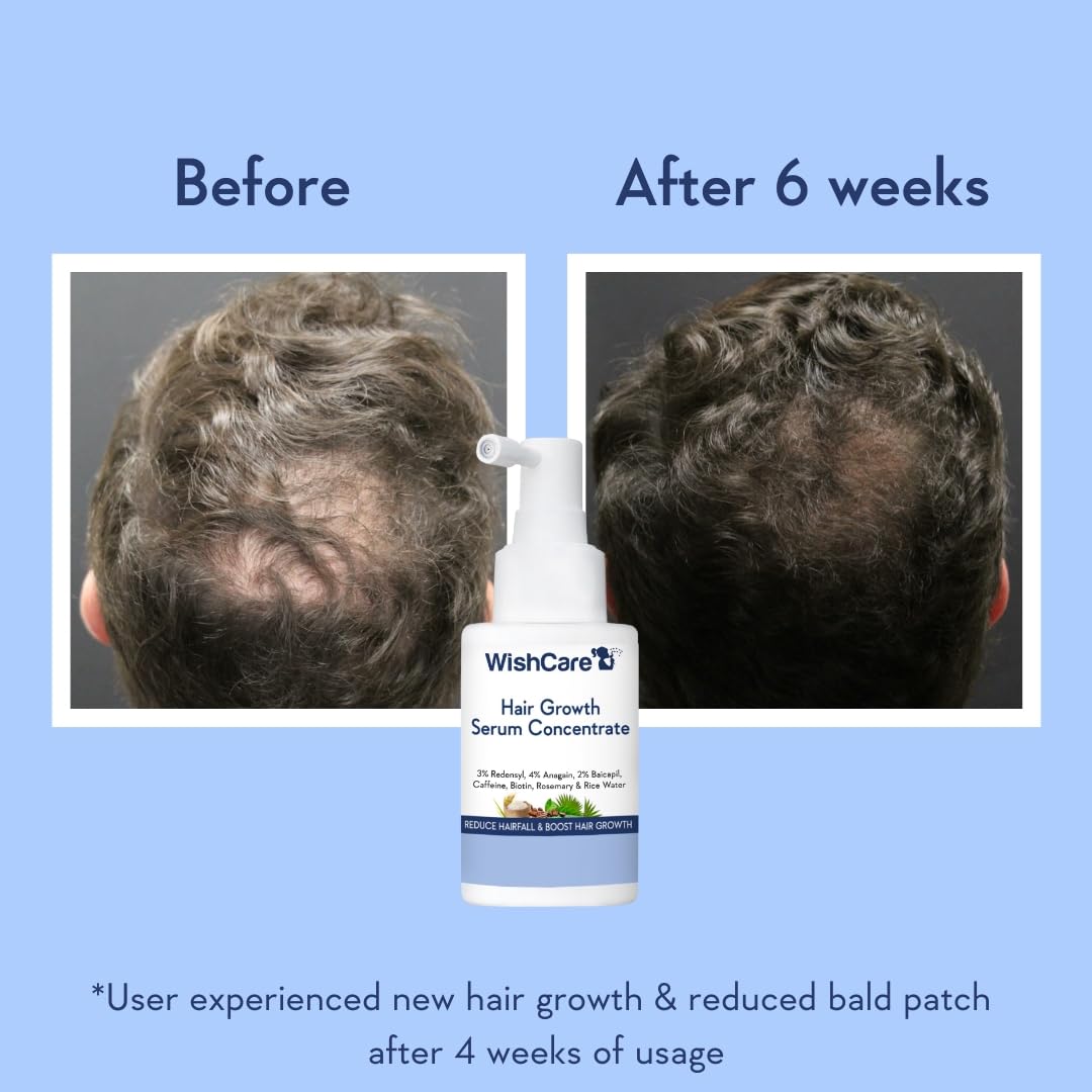 Wishcare Hair Growth Serum Concentrate With  Rice Water - 30 ml